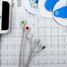 Registador de eventos cardíaco