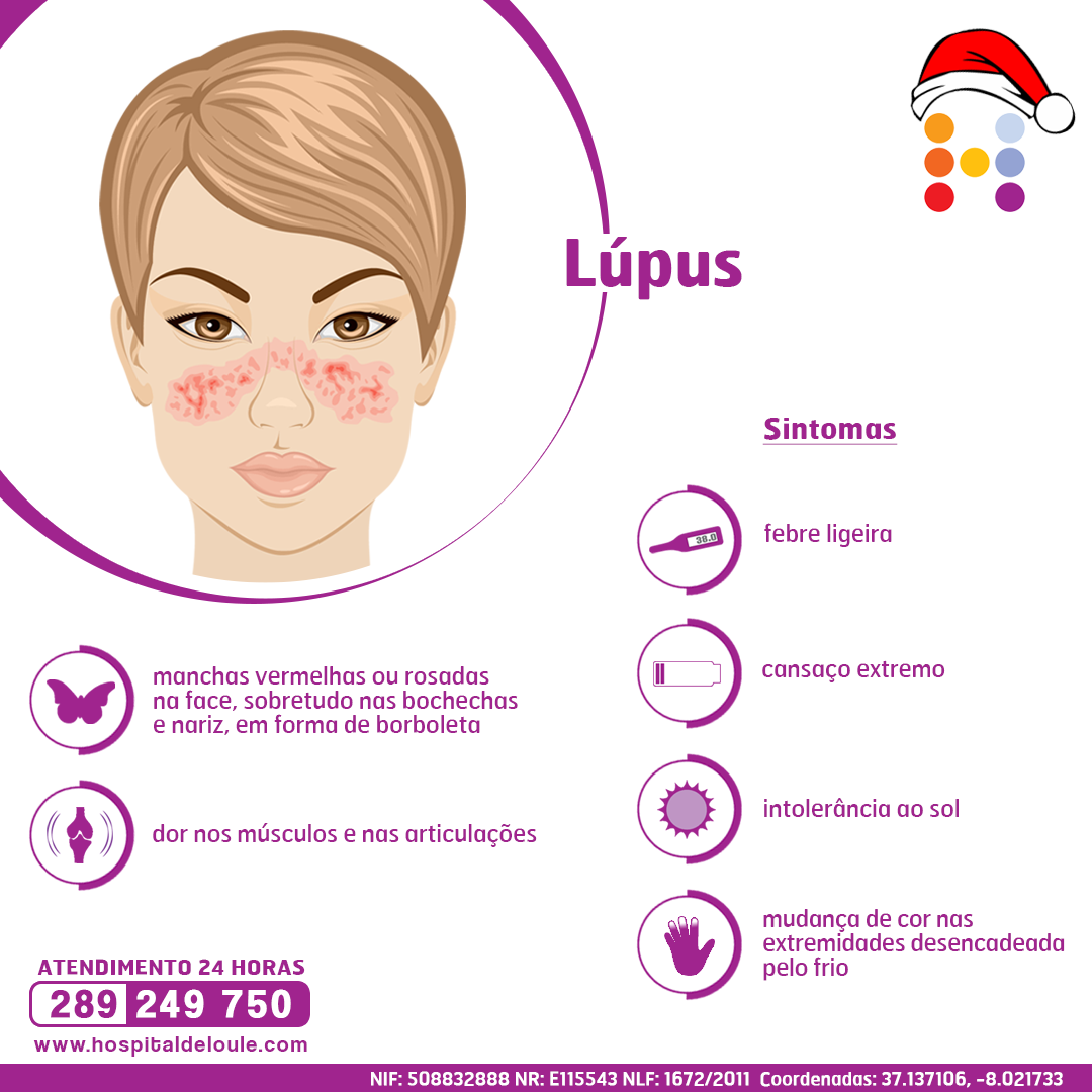 Lúpus Hospital de Loulé