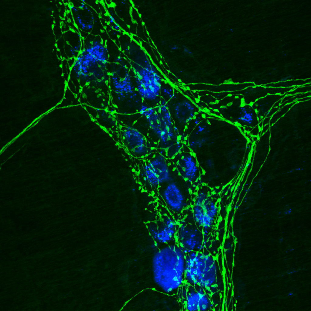 Immunocytochemistry