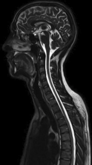 Magnetic Resonance Imaging